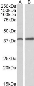 WB analysis of mouse ovary (A) and rat uterus (B) lysate using GTX88367 PRKCDBP antibody, Internal. Dilution : 0.3microg/ml Loading : 35microg protein in RIPA buffer