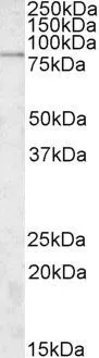 WB analysis of A549 lysate using GTX88368 SGSM3 antibody, Internal. Dilution : 2microg/ml Loading : 35microg protein in RIPA buffer WB analysis of A549 lysate using GTX88368 SGSM3 antibody, Internal. Dilution : 2microg/ml Loading : 35microg protein in RIPA buffer