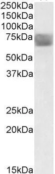 WB analysis of human placenta lysate using GTX88372 TPP1 antibody, Internal. Dilution : 0.3microg/ml Loading : 35microg protein in RIPA buffer WB analysis of human placenta lysate using GTX88372 TPP1 antibody, Internal. Dilution : 0.3microg/ml Loading : 35microg protein in RIPA buffer