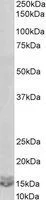 WB analysis of Daudi lysate using GTX88379 CXCL2 / GRO beta antibody, C-term. Dilution : 0.03microg/ml Loading : 35microg protein in RIPA buffer WB analysis of Daudi lysate using GTX88379 CXCL2 / GRO beta antibody, C-term. Dilution : 0.03microg/ml Loading : 35microg protein in RIPA buffer
