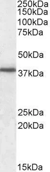 WB analysis of human peripheral blood mononucleocyte lysate using GTX88380 JAM-A antibody, C-term. Dilution : 0.3microg/ml Loading : 35microg protein in RIPA buffer WB analysis of human peripheral blood mononucleocyte lysate using GTX88380 JAM-A antibody, C-term. Dilution : 0.3microg/ml Loading : 35microg protein in RIPA buffer