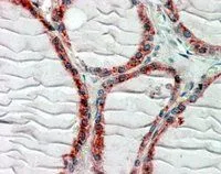 IHC-P analysis of human thyroid Gland using GTX88382 CLIP170 antibody, C-term. Antigen retrieval : citrate buffer pH 6 Dilution : 2.5microg/ml