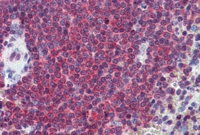 IHC-P analysis of human spleen using GTX88385 Carbonic Anhydrase 1 antibody, Internal. Antigen retrieval : citrate buffer pH 6 Dilution : 2.5microg/ml IHC-P analysis of human spleen using GTX88385 Carbonic Anhydrase 1 antibody, Internal. Antigen retrieval : citrate buffer pH 6 Dilution : 2.5microg/ml