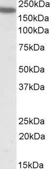 WB analysis of human spleen lysate using GTX88390 CD11a antibody, Internal. Dilution : 0.5microg/ml Loading : 35microg protein in RIPA buffer WB analysis of human spleen lysate using GTX88390 CD11a antibody, Internal. Dilution : 0.5microg/ml Loading : 35microg protein in RIPA buffer