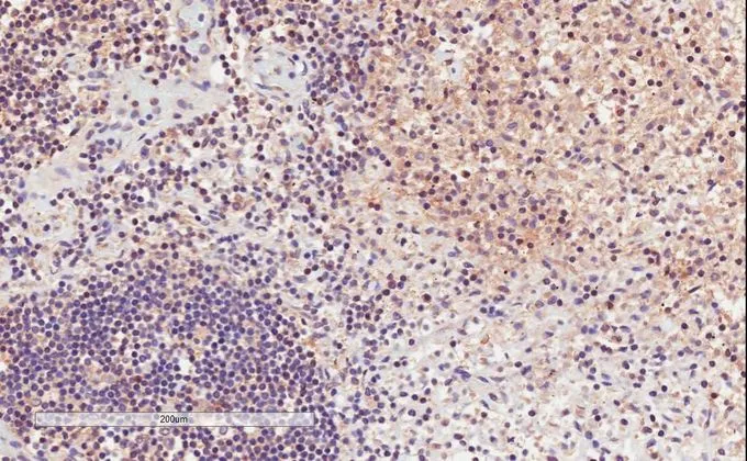 IHC-P analysis of human lymph node using GTX88390 CD11a antibody, Internal. Antigen retrieval : citrate buffer pH 6 Dilution : 2microg/ml