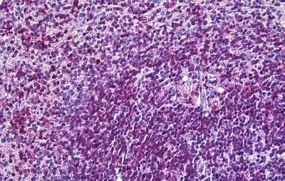 IHC-P analysis of human spleen using GTX88390 CD11a antibody, Internal. Antigen retrieval : citrate buffer pH 6 Dilution : 3.75microg/ml