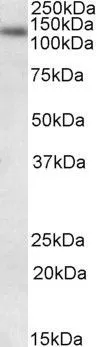WB analysis of HeLa nuclear lysate using GTX88393 DNA ligase I antibody, Internal (near C-Terminus). Dilution : 0.1microg/ml Loading : 35microg protein in RIPA buffer WB analysis of HeLa nuclear lysate using GTX88393 DNA ligase I antibody, Internal (near C-Terminus). Dilution : 0.1microg/ml Loading : 35microg protein in RIPA buffer