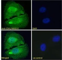 ICC/IF analysis of PFA fixed U2OS cells using GTX88402 Nkx2.5 antibody, Internal. Green : Primary antibody Blue : DAPI Negative control : Unimmunized goat IgG Permeabilization : 0.15% Triton Dilution : 5microg/ml ICC/IF analysis of PFA fixed U2OS cells using GTX88402 Nkx2.5 antibody, Internal. Green : Primary antibody Blue : DAPI Negative control : Unimmunized goat IgG Permeabilization : 0.15% Triton Dilution : 5microg/ml