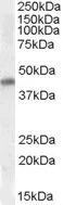 WB analysis of human heart lysate using GTX88402 Nkx2.5 antibody, Internal. Dilution : 0.3microg/ml Loading : 35microg protein in RIPA buffer
