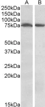 WB analysis of mouse (A) and rat (B) brain using GTX88403 STK39 antibody, Internal. Dilution : 1microg/ml Loading : 35microg protein in RIPA buffer
