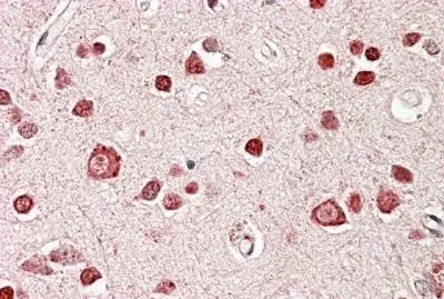 IHC-P analysis of human cerebral cortex using GTX88403 STK39 antibody, Internal. Antigen retrieval : citrate buffer pH 6 Dilution : 3.8microg/ml
