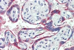 IHC-P analysis of human placenta using GTX88404 NOX2 / gp91phox antibody, Internal. Antigen retrieval : citrate buffer pH 6 Dilution : 3.8microg/ml IHC-P analysis of human placenta using GTX88404 NOX2 / gp91phox antibody, Internal. Antigen retrieval : citrate buffer pH 6 Dilution : 3.8microg/ml