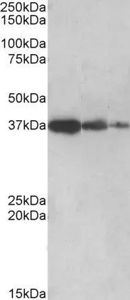 WB analysis of human liver lysate (lane 1),mouse liver (lane 2) and rat liver (lane 3) using GTX88415 PPP2R4 antibody,C-term. Dilution : 0.5ug/ml Loading : 35ug protein in RIPA buffer