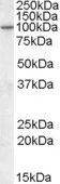 WB analysis of human amygdala lysate using GTX88422 CENTG1 antibody, Internal. Dilution : 0.3microg/ml Loading : 35microg protein in RIPA buffer WB analysis of human amygdala lysate using GTX88422 CENTG1 antibody, Internal. Dilution : 0.3microg/ml Loading : 35microg protein in RIPA buffer