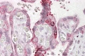 IHC-P analysis of human placenta using GTX88427 NCE2 antibody, C-term. It shows membrane staining in trophoblasts. Dilution : 2.5-3.8microg/ml IHC-P analysis of human placenta using GTX88427 NCE2 antibody, C-term. It shows membrane staining in trophoblasts. Dilution : 2.5-3.8microg/ml