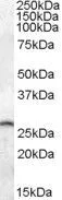 WB analysis of mouse brain lysate using GTX88433 PSPH antibody, C-term. Dilution : 0.05microg/ml Loading : 35microg protein in RIPA buffer WB analysis of mouse brain lysate using GTX88433 PSPH antibody, C-term. Dilution : 0.05microg/ml Loading : 35microg protein in RIPA buffer