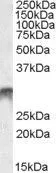 WB analysis of human bone marrow lysate using GTX88434 DLX5 antibody, Internal. Dilution : 1microg/ml Loading : 35microg protein in RIPA buffer WB analysis of human bone marrow lysate using GTX88434 DLX5 antibody, Internal. Dilution : 1microg/ml Loading : 35microg protein in RIPA buffer