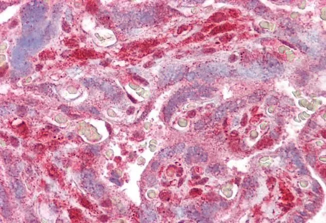 IHC-P analysis of human placenta using GTX88434 DLX5 antibody, Internal. Antigen retrieval : citrate buffer pH 6 Dilution : 2.5microg/ml