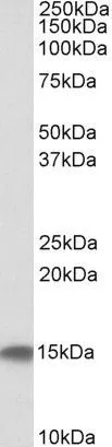 WB analysis of human testis lysate using GTX88441 Cystatin C antibody, Internal. Dilution : 0.1microg/ml Loading : 35microg protein in RIPA buffer WB analysis of human testis lysate using GTX88441 Cystatin C antibody, Internal. Dilution : 0.1microg/ml Loading : 35microg protein in RIPA buffer
