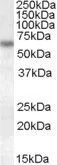 WB analysis of HeLa lysate using GTX88443 Granulins antibody, Internal. Dilution : 1microg/ml Loading : 35microg protein in RIPA buffer WB analysis of HeLa lysate using GTX88443 Granulins antibody, Internal. Dilution : 1microg/ml Loading : 35microg protein in RIPA buffer