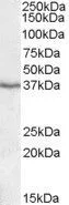 WB analysis of human liver lysate using GTX88446 PON1 antibody, Internal. Dilution : 1microg/ml Loading : 35microg protein in RIPA buffer WB analysis of human liver lysate using GTX88446 PON1 antibody, Internal. Dilution : 1microg/ml Loading : 35microg protein in RIPA buffer