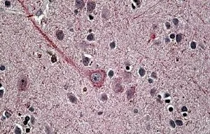 IHC-P analysis of human brain using GTX88461 Synaptotagmin 1 antibody, Internal. Antigen retrieval : citrate buffer pH 6 Dilution : 3.8microg/ml