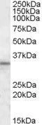 WB analysis of human testis lysate using GTX88468 HAX1 antibody, Internal. Dilution : 1microg/ml Loading : 35microg protein in RIPA buffer WB analysis of human testis lysate using GTX88468 HAX1 antibody, Internal. Dilution : 1microg/ml Loading : 35microg protein in RIPA buffer