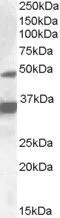 WB analysis of HepG2 lysate using GTX88474 PXR antibody, Internal. Dilution : 1microg/ml Loading : 35microg protein in RIPA buffer WB analysis of HepG2 lysate using GTX88474 PXR antibody, Internal. Dilution : 1microg/ml Loading : 35microg protein in RIPA buffer