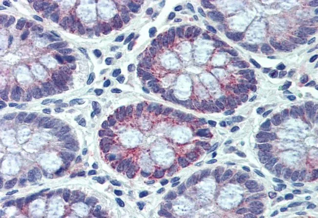 IHC-P analysis of human small intestine using GTX88474 PXR antibody, Internal. Antigen retrieval : citrate buffer pH 6 Dilution : 3.75microg/ml