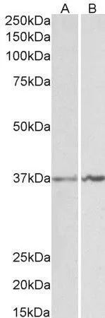 WB analysis of K562 (A) and NIH-3T3 (B) lysates using GTX88476 Annexin A1 antibody, C-term. Dilution : 1microg/ml Loading : 35microg protein in RIPA buffer WB analysis of K562 (A) and NIH-3T3 (B) lysates using GTX88476 Annexin A1 antibody, C-term. Dilution : 1microg/ml Loading : 35microg protein in RIPA buffer