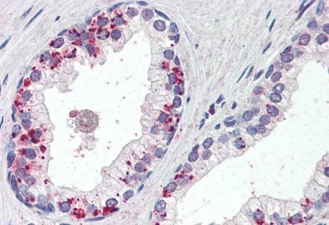 IHC-P analysis of human prostate using GTX88476 Annexin A1 antibody, C-term. Antigen retrieval : citrate buffer pH 6 Dilution : 4microg/ml