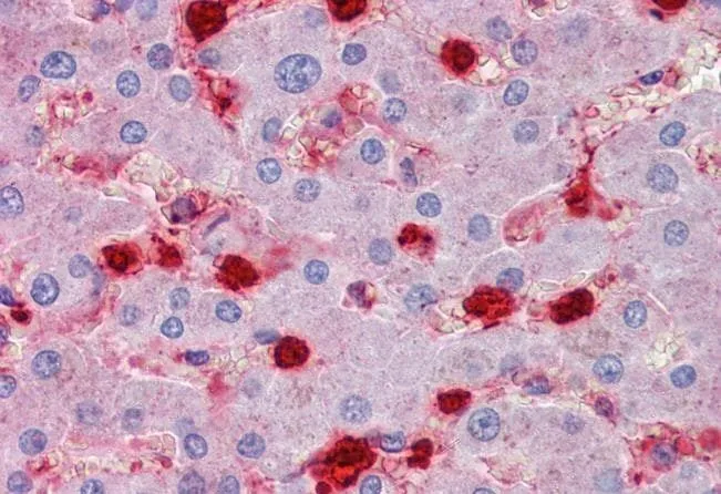 IHC-P analysis of human liver using GTX88481 S100A9 antibody, Internal. Antigen retrieval : citrate buffer pH 6 Dilution : 2.5microg/ml