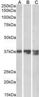 WB analysis of pig (A), mouse (B) and rat (C) liver lysates using GTX88484 Arginase 1 antibody, C-term. Dilution : 0.03microg/ml Loading : 35microg protein in RIPA buffer