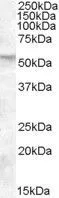 WB analysis of human placenta lysate using GTX88487 FKBP4 antibody, C-term. Dilution : 0.01microg/ml Loading : 35microg protein in RIPA buffer WB analysis of human placenta lysate using GTX88487 FKBP4 antibody, C-term. Dilution : 0.01microg/ml Loading : 35microg protein in RIPA buffer