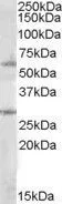WB analysis of Daudi lysate using GTX88488 SOCS7 antibody, Internal. Dilution : 1microg/ml Loading : 35microg protein in RIPA buffer WB analysis of Daudi lysate using GTX88488 SOCS7 antibody, Internal. Dilution : 1microg/ml Loading : 35microg protein in RIPA buffer