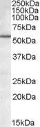 WB analysis of Jurkat lysate using GTX88490 BAG5 antibody, Internal. Dilution : 1microg/ml Loading : 35microg protein in RIPA buffer WB analysis of Jurkat lysate using GTX88490 BAG5 antibody, Internal. Dilution : 1microg/ml Loading : 35microg protein in RIPA buffer