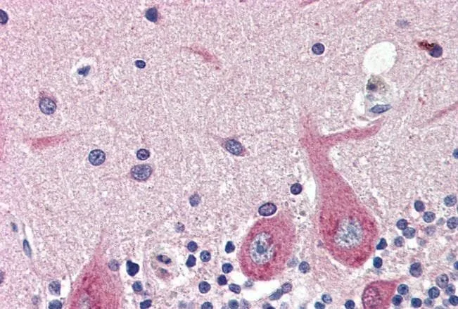 IHC-P analysis of human cerebellum using GTX88492 GAD67 antibody, Internal. Antigen retrieval : citrate buffer pH 6 Dilution : 4microg/ml IHC-P analysis of human cerebellum using GTX88492 GAD67 antibody, Internal. Antigen retrieval : citrate buffer pH 6 Dilution : 4microg/ml
