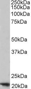 WB analysis of human placenta lysate using GTX88497 Ferritin Heavy chain antibody, C-term. Dilution : 1microg/ml Loading : 35microg protein in RIPA buffer WB analysis of human placenta lysate using GTX88497 Ferritin Heavy chain antibody, C-term. Dilution : 1microg/ml Loading : 35microg protein in RIPA buffer