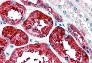 IHC-P analysis of human kidney using GTX88497 Ferritin Heavy chain antibody, C-term. Antigen retrieval : citrate buffer pH 6 Dilution : 4microg/ml