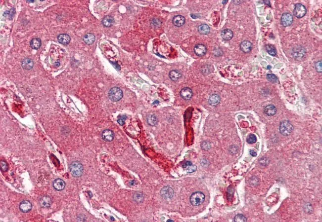 IHC-P analysis of human liver using GTX88497 Ferritin Heavy chain antibody, C-term. Antigen retrieval : citrate buffer pH 6 Dilution : 4microg/ml