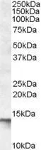 WB analysis of human skeletal muscle lysate using GTX88500 C1D antibody, C-term. Dilution : 0.1microg/ml Loading : 35microg protein in RIPA buffer WB analysis of human skeletal muscle lysate using GTX88500 C1D antibody, C-term. Dilution : 0.1microg/ml Loading : 35microg protein in RIPA buffer