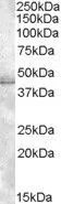 WB analysis of HeLa lysate using GTX88502 Muscleblind-like 1 antibody, C-term. Dilution : 1microg/ml Loading : 35microg protein in RIPA buffer WB analysis of HeLa lysate using GTX88502 Muscleblind-like 1 antibody, C-term. Dilution : 1microg/ml Loading : 35microg protein in RIPA buffer