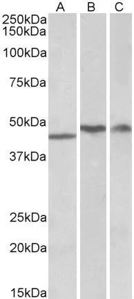 WB analysis of human cerebellum (A), frontal Cotex (B) and hippocampus (C) lysates using GTX88503 TDP43 antibody, Internal. Dilution : 1microg/ml Loading : 35microg protein in RIPA buffer