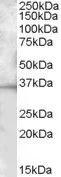 WB analysis of mouse spleen lysate using GTX88506 CD272 antibody, C-term. Dilution : 1microg/ml Loading : 35microg protein in RIPA buffer WB analysis of mouse spleen lysate using GTX88506 CD272 antibody, C-term. Dilution : 1microg/ml Loading : 35microg protein in RIPA buffer