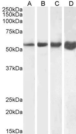WB analysis of human (A), mouse (B), rat (C) and pig (D) skeletal muscle lysate using GTX88510 Desmin antibody, C-term. Dilution : 1microg/ml Loading : 35microg protein in RIPA buffer WB analysis of human (A), mouse (B), rat (C) and pig (D) skeletal muscle lysate using GTX88510 Desmin antibody, C-term. Dilution : 1microg/ml Loading : 35microg protein in RIPA buffer