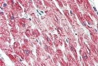 IHC-P analysis of human heart using GTX88510 Desmin antibody, C-term. Antigen retrieval : citrate buffer pH 6 Dilution : 3.75microg/ml