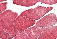IHC-P analysis of human skeletal muscle using GTX88510 Desmin antibody, C-term. Antigen retrieval : citrate buffer pH 6 Dilution : 5microg/ml