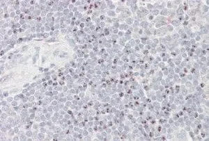 IHC-P analysis of human spleen using GTX88511 BAT3 antibody, Internal. Antigen retrieval : citrate buffer pH 6 Dilution : 3.8microg/ml IHC-P analysis of human spleen using GTX88511 BAT3 antibody, Internal. Antigen retrieval : citrate buffer pH 6 Dilution : 3.8microg/ml