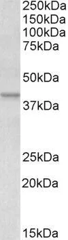 WB analysis of human placenta lysate using GTX88518 Apolipoprotein L1 antibody, C-term. Dilution : 0.1microg/ml Loading : 35microg protein in RIPA buffer WB analysis of human placenta lysate using GTX88518 Apolipoprotein L1 antibody, C-term. Dilution : 0.1microg/ml Loading : 35microg protein in RIPA buffer