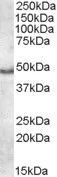 WB analysis of human frontal cortex lysate using GTX88519 Apolipoprotein L5 antibody, C-term. Dilution : 1microg/ml Loading : 35microg protein in RIPA buffer WB analysis of human frontal cortex lysate using GTX88519 Apolipoprotein L5 antibody, C-term. Dilution : 1microg/ml Loading : 35microg protein in RIPA buffer